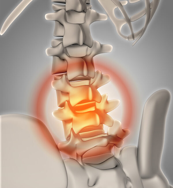 Lumbar Sympathetic Nerve Block – Genesis